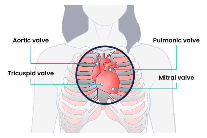 Diagram showing from a woman’s torso with four labels. The diagram shows ribs and lungs with the heart sitting on top where it would typically be located underneath the lungs and ribs. Four labels point to the heart. The top left label points to the aortic valve. The top right label points to the pulmonic valve. The bottom left label points to the tricuspid valve, and the bottom right label points to the mitral valve.