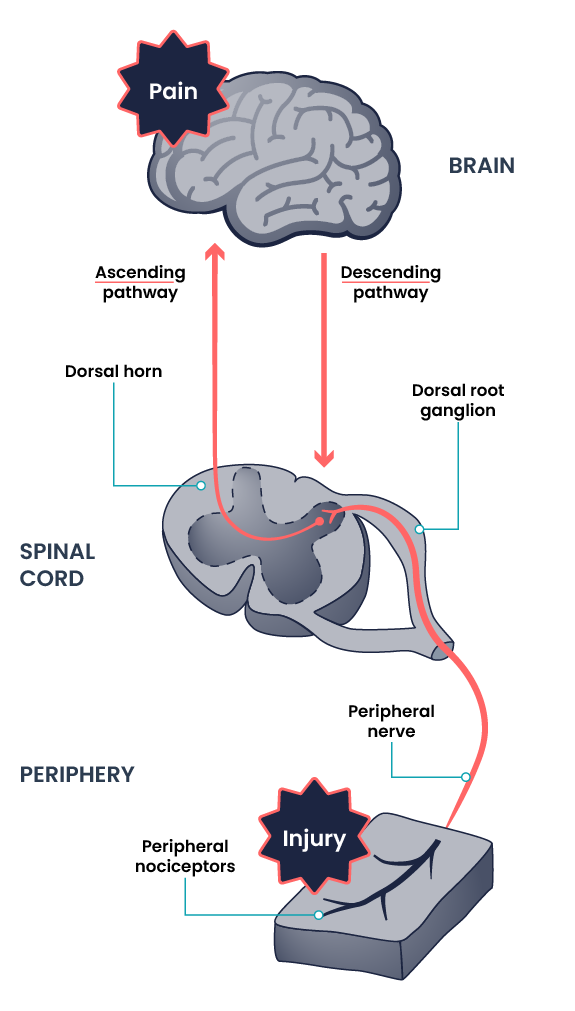 A coloured diagram demonstrating the processes of nociception. The top of the diagram contains a brain graphic with the word pain layered over the top. Below the brain are two arrows. The arrow on the left points up to the brain from the spinal cord. A label beside this arrow reads Ascending pathway. The arrow on the right points down from the brain to the spinal cord, with a label reading Descending pathway. The spinal cord graphic highlights the dorsal horn and dorsal root ganglion. Below this graphic is the periphery, with a graphic of peripheral nociceptors at the bottom of the diagram. The periphery graphic contains the word injury, and a peripheral nerve leads from this graphic up through the dorsal root ganglion and dorsal horn in the spinal cord to the ascending pathway leading to the brain.