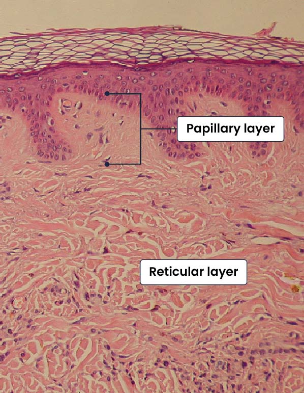 A stained slide of the dermis showing the different fibres of the papillary and reticular layers.