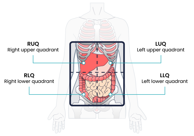 Diagram showing from a woman’s torso with four labels. The diagram shows ribs and lungs with the heart sitting on top where it would typically be located underneath the lungs and ribs. Four labels point to the heart. The top left label points to the aortic valve. The top right label points to the pulmonic valve. The bottom left label points to the tricuspid valve, and the bottom right label points to the mitral valve.