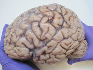 Gloved hands of a person holding a human brain