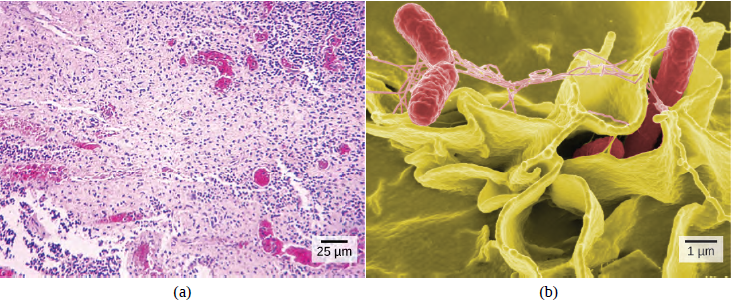 Two horizontal images with part (a) on the left showing Salmonella bacteria viewed with a light microscope. On the right, part (b) displays Scanning electron micrograph showing Salmonella bacteria (in red) invading human cells.