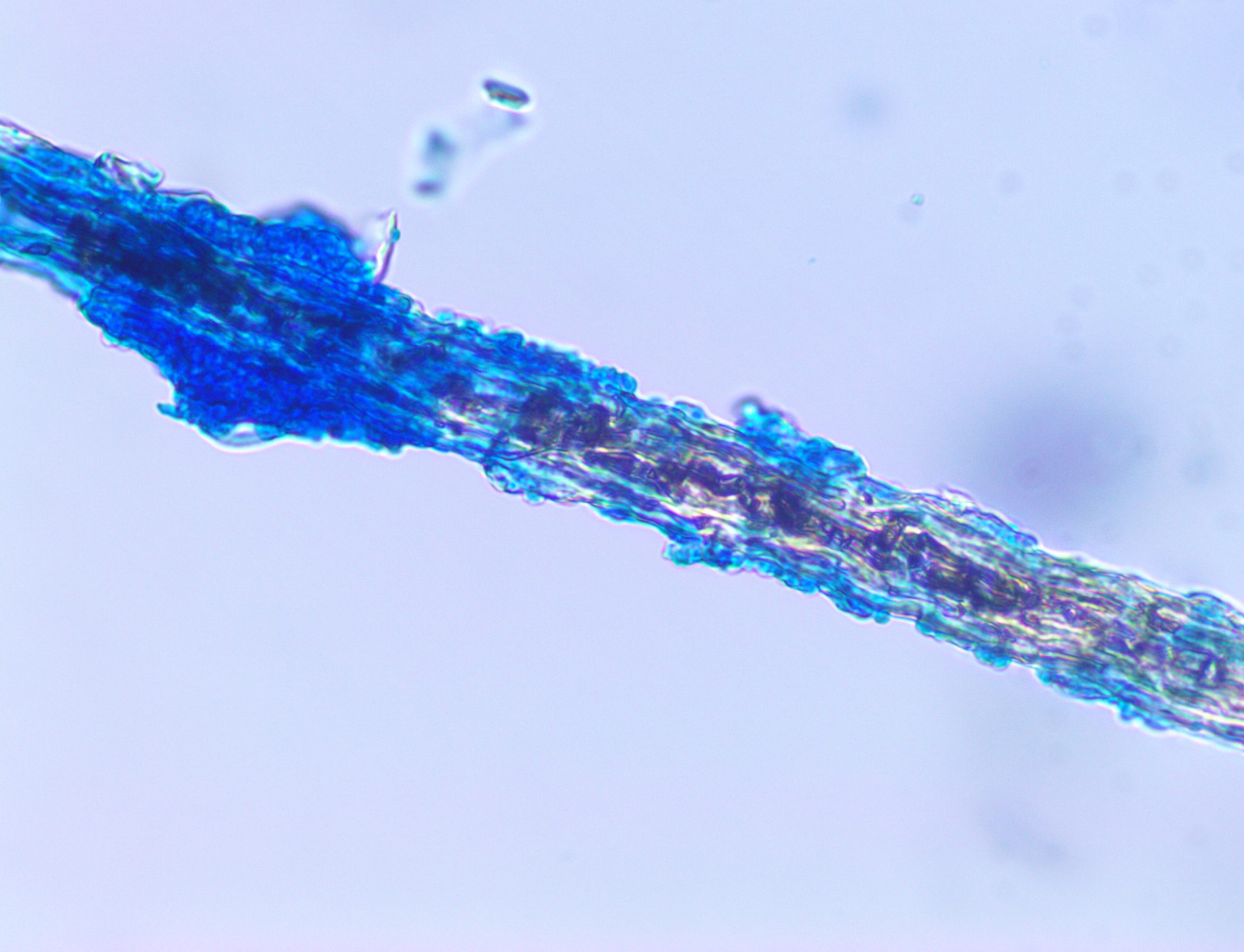 Cat hair showing ectothrix with the presence of arthroconidia on the hair shaft. Stained with lactophenol cotton blue