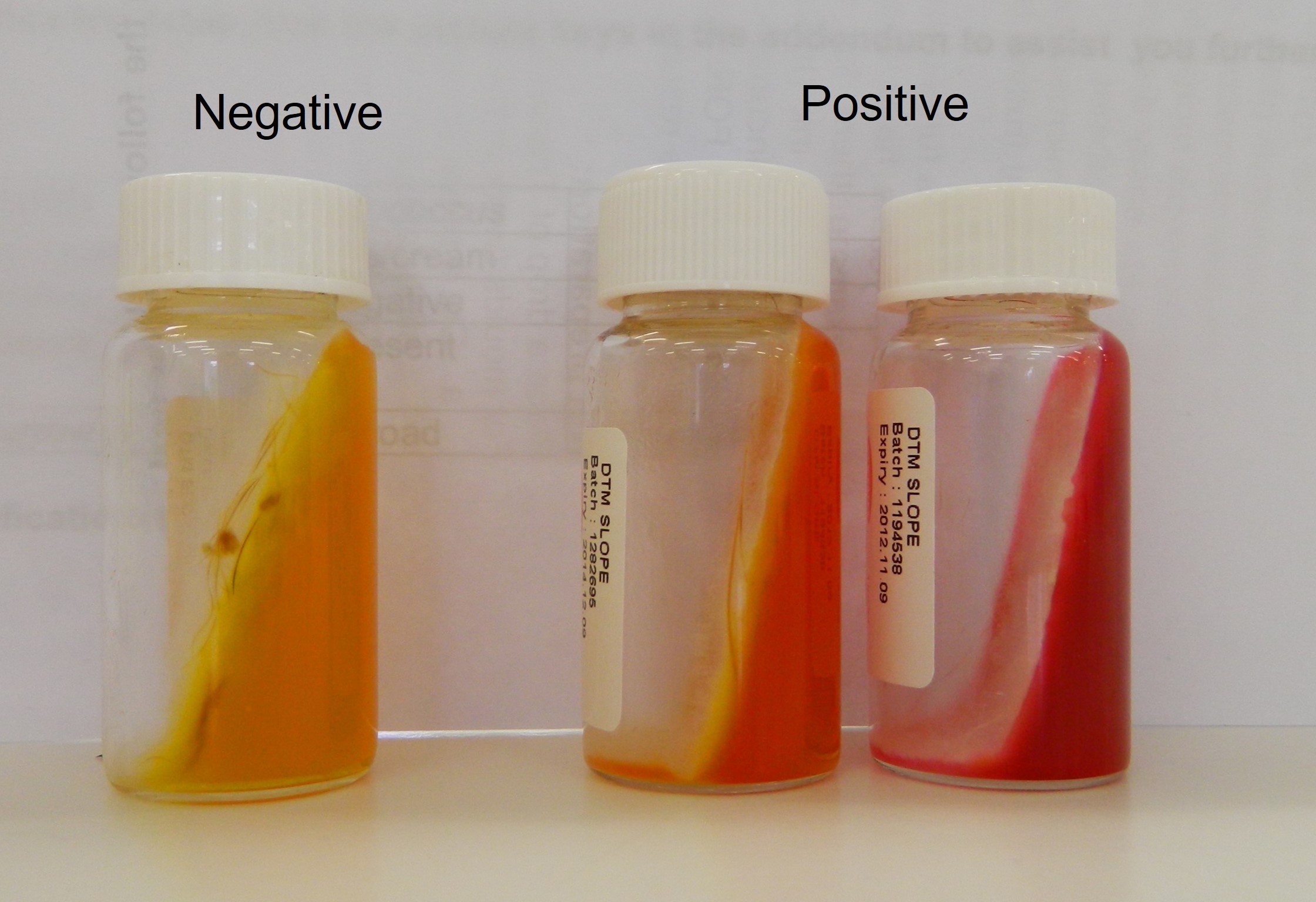 Growth of dermatophytes on dermatophyte test medium. The test medium on the far right is positive for a dermatophyte. The middle suspect and the left negative. Note that the dermatophytes never produce dark colonies.