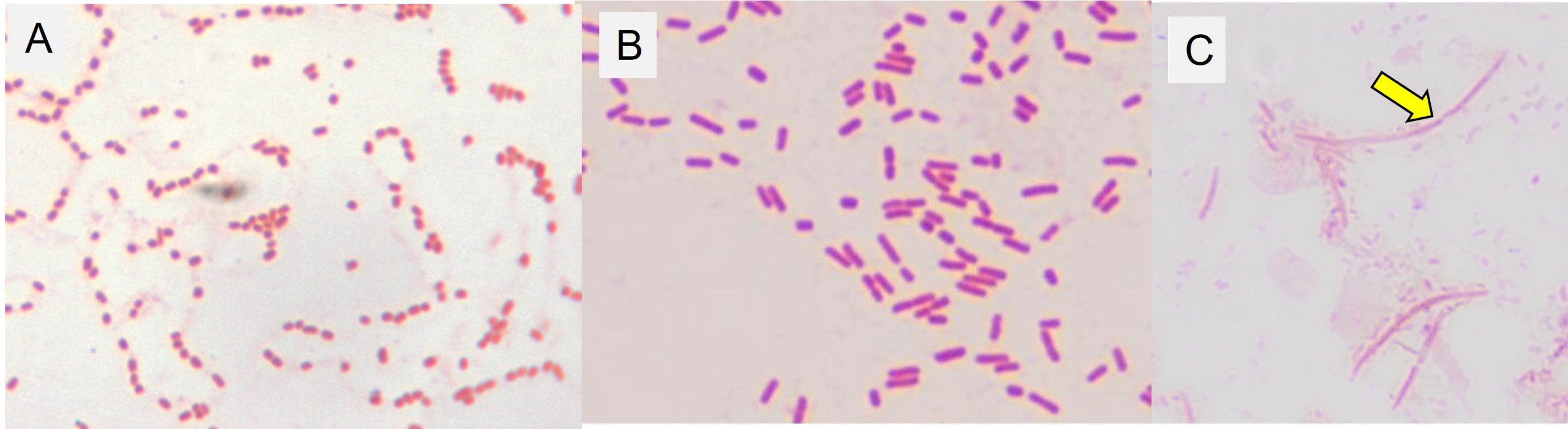 Escherichia coli observed in the urine of 3 dogs. Picture A shows coccoid forms. These often are the form in the intracellular microconlonies; Picture B shows the normal rod shaped form and Picture C shows the filamentous form which is often present in response to beta-lactam antibiotic treatment.