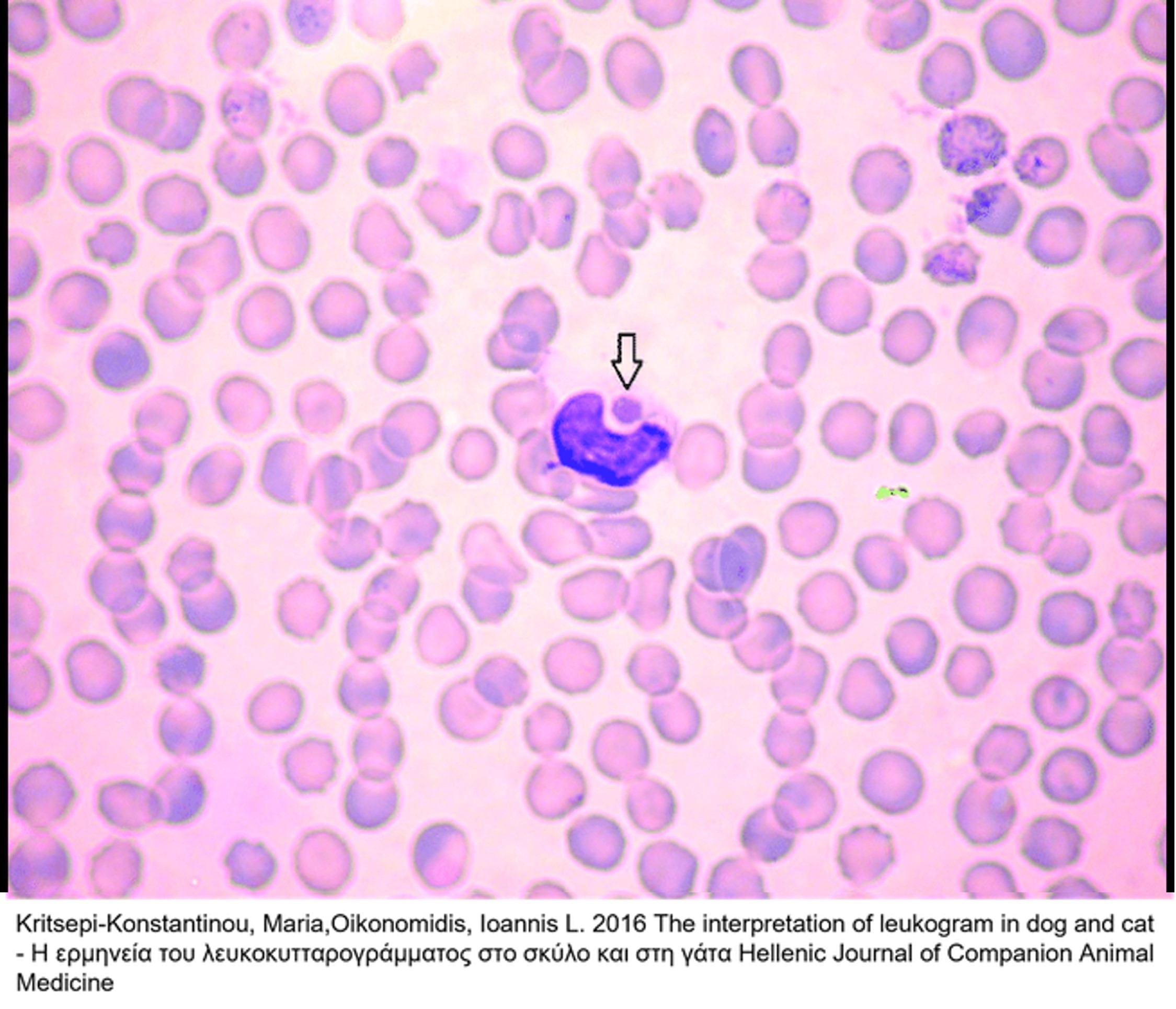 Erhlichia canis morula in the cytoplasm of a monocyte of a dog with acute erhlichiosis