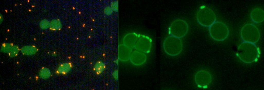 Acridine orange blue staining of red blood cells, showing Mycoplasma haemofelis fluorescing under UV light