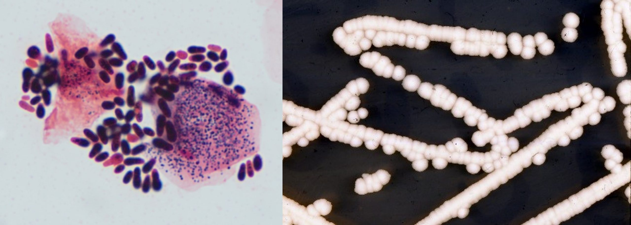 Malassezia pachydermatitis: Gram's stain of an ear exudate from a dog suffering from otitis externa. Right picture. Two day growth of Malassezia on Sabouraud's dextrose agar.