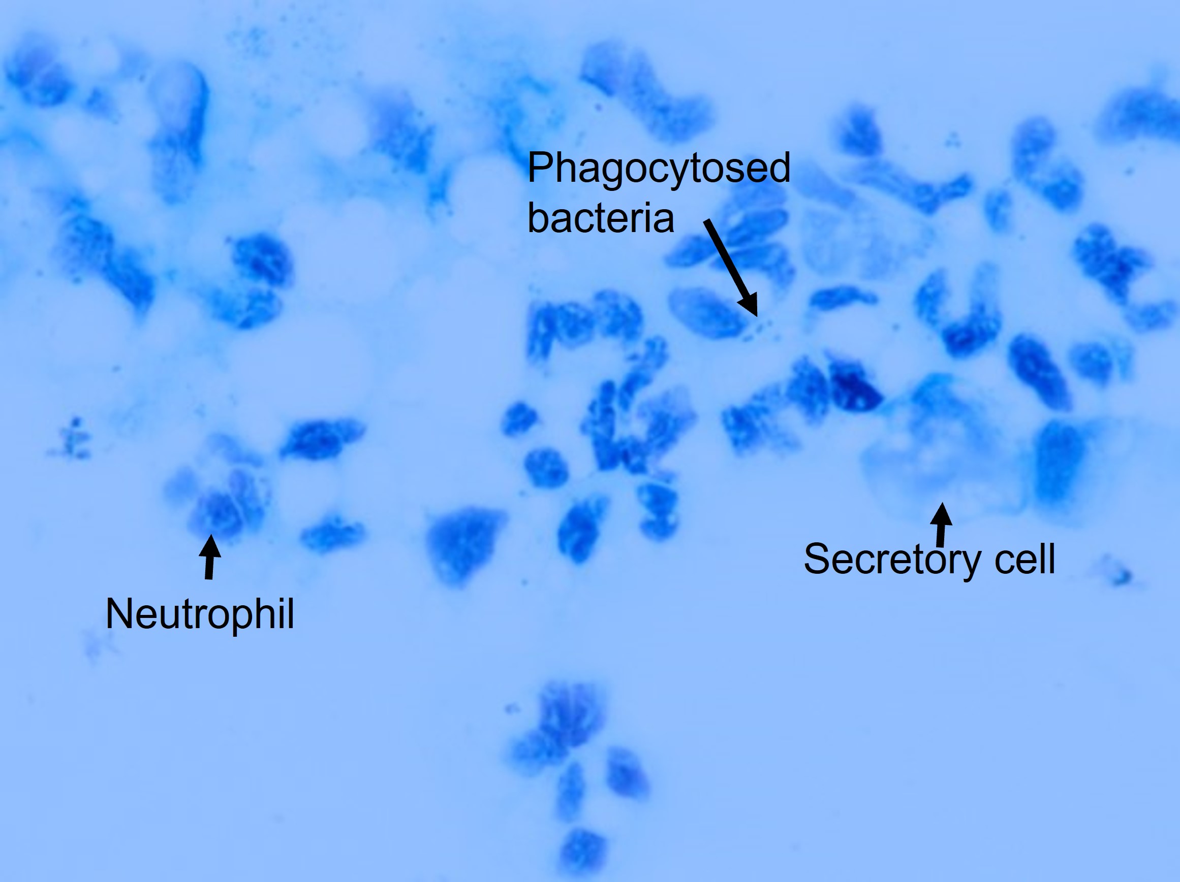 Trypan blue stain of milk x400 magnfication