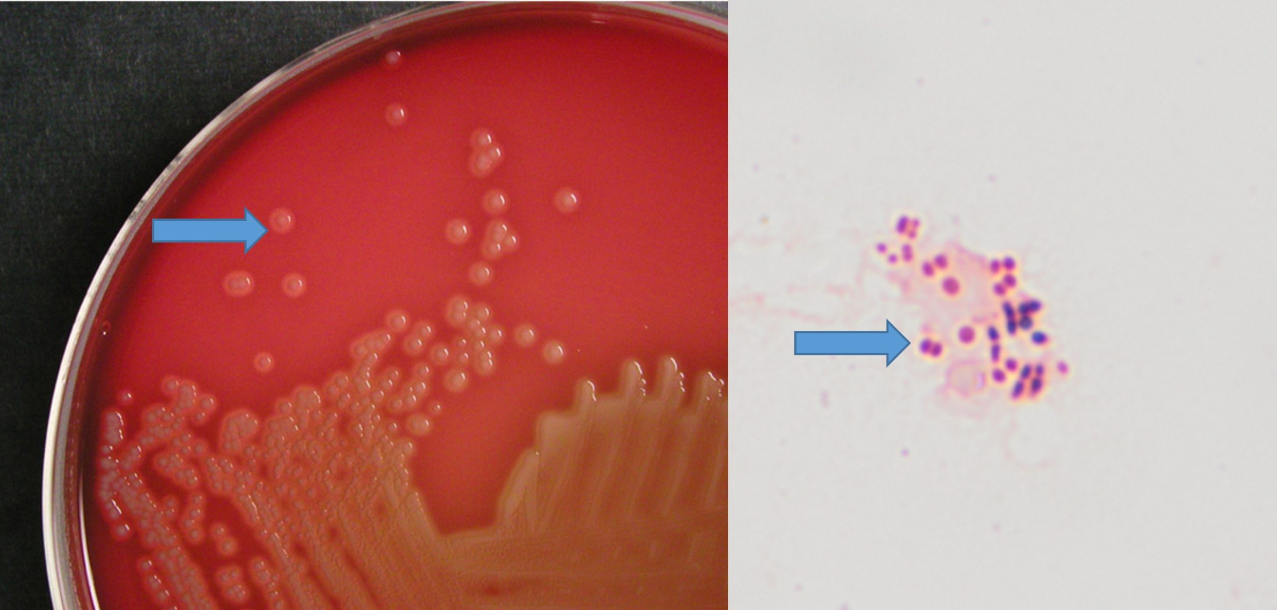 Growth of Moraxella bovis on blood agar as beta-haemolytic colonies. Gram-negative cocci are present in cytology of a corneal ulcer.