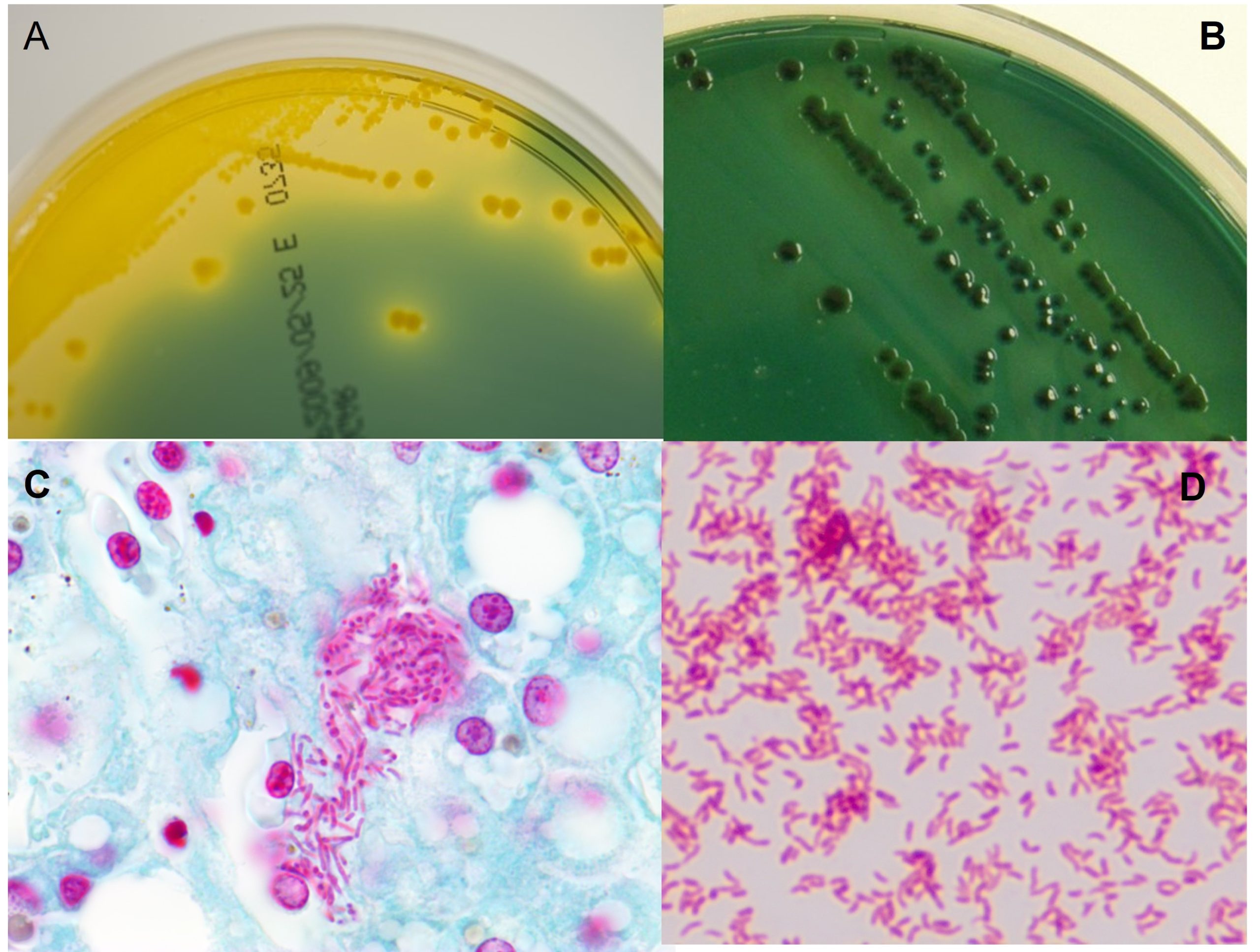 Vibrio species cultured from fish. A: TBCS a selective medium for Vibrio species showing sucrose fermentation by Vibrio alginolyticus; Picture B: Non-sucrose fermenting pathogen Vibrio harveyi on TCBS. Picture C: Gram's stain of Vibrio harveyi in the hepatopacreas of a shark; Picture D: Gram's stain of a culture of V. harveyi.
