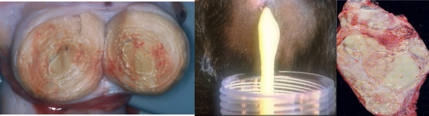 Gross examination of pus
