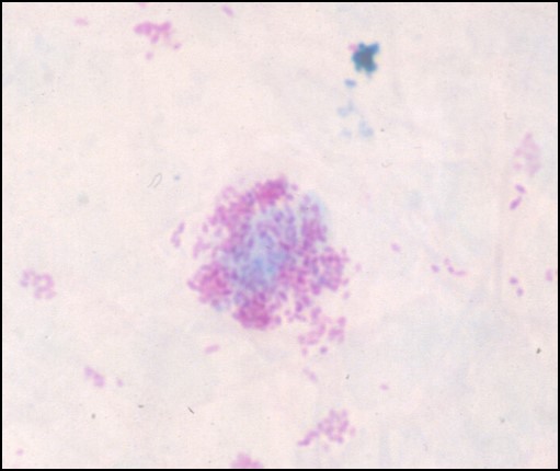 Stamps stain of intracellular brucellae