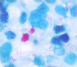 "Nests" of acid-fast cocci (pink cocci) present in faeces or in tissue is suggestive of M. avium ssp. paratuberculosis