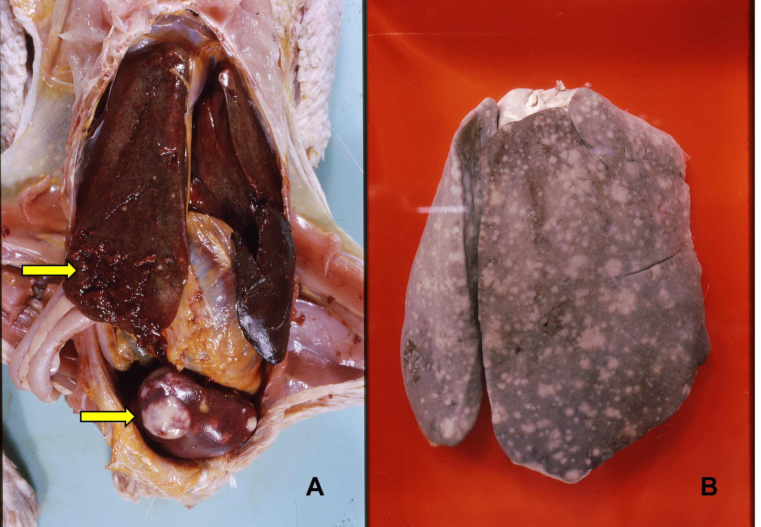 Avian tuberculosis of the liver and spleen. Picture A: shows granulomas of the spleen and the liver. Picture B: is formalin-fixed liver showing miliary lesions.
