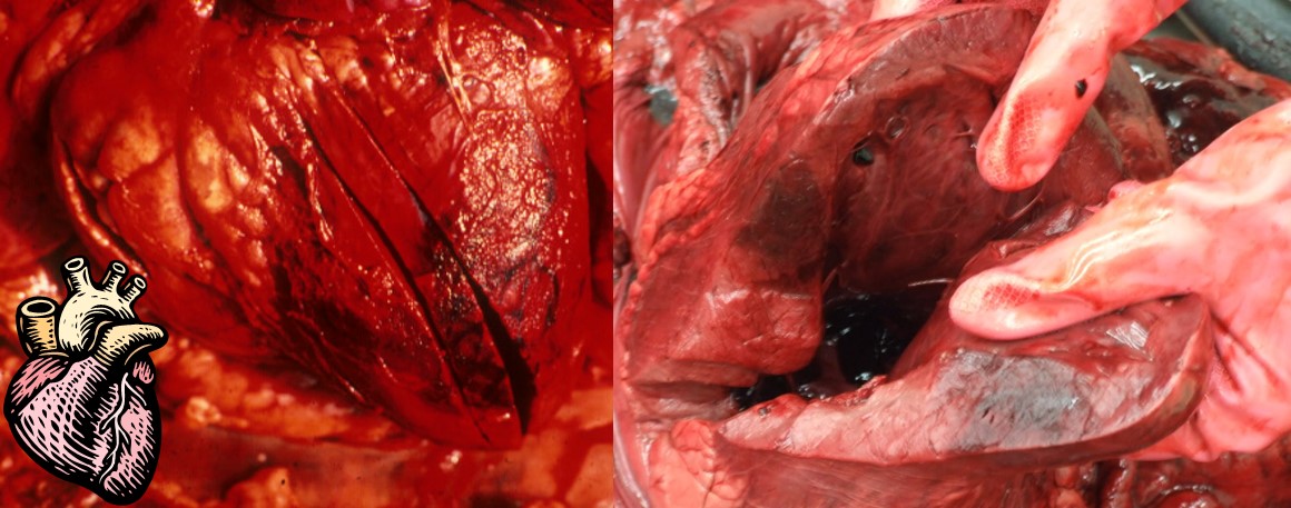 Blackquarter (blackleg) in the heart muscles of cattle