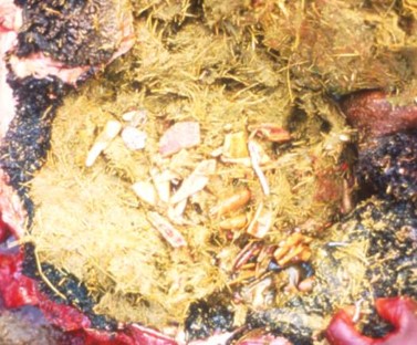Fragments of bone in the rumen of a cow that died from botulism.