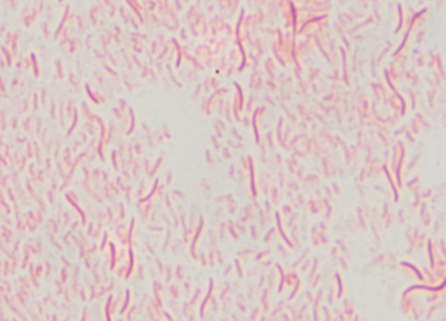 Gram's stain of a Brachyspira culture
