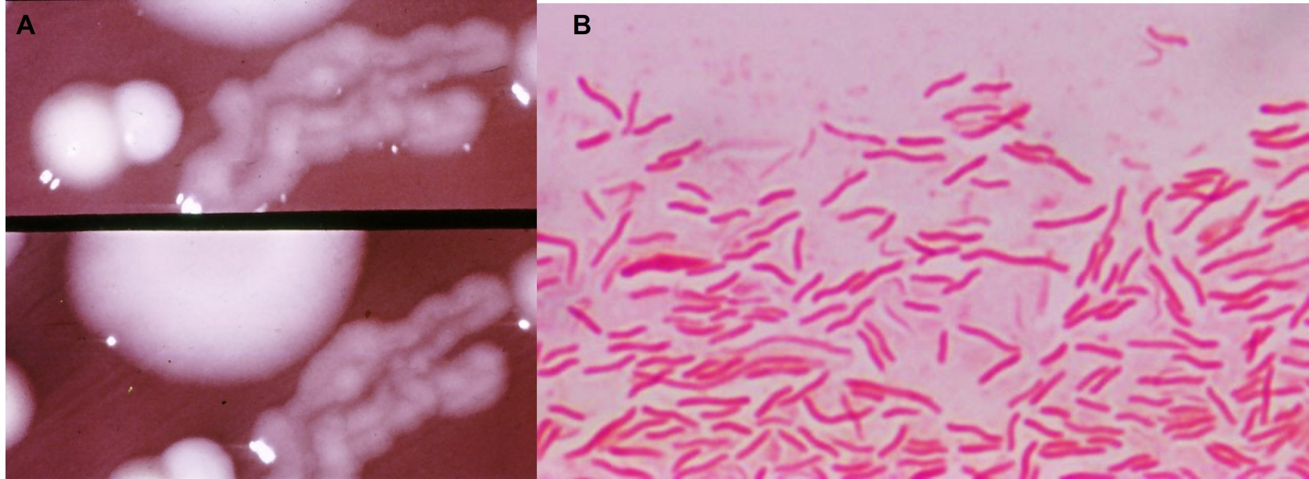 A: Culture of Campylobacter on blood agar. Colonies are very small, mucoid and appear to form a film over the afar. B: Gram's stain of a Campylobacer fetus ssp. venerealis culture.