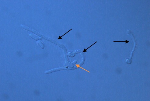 Germ tube production by Candida albicans, The black arrows point to germ tubes and the orange arrow to a yeast cell