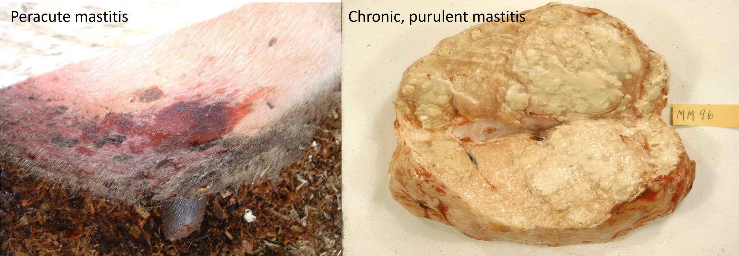 clinical mastitis in cows :peracute and chronic
