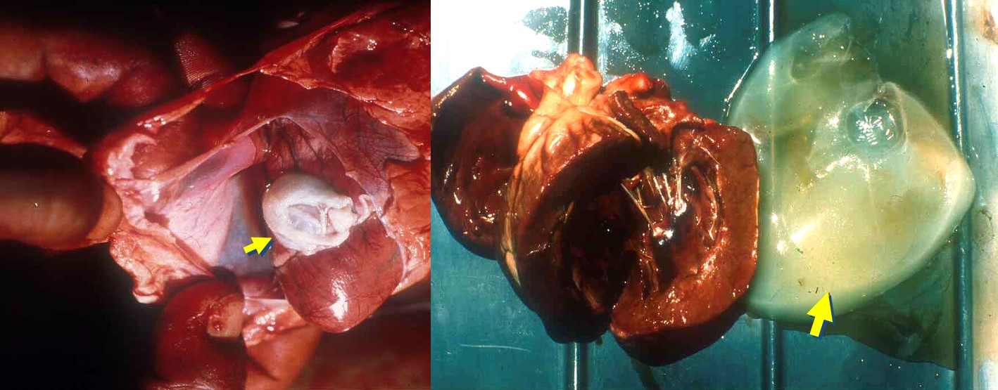 ibrin clots in the pericardium in lambs suffering from pulpy kidney disease