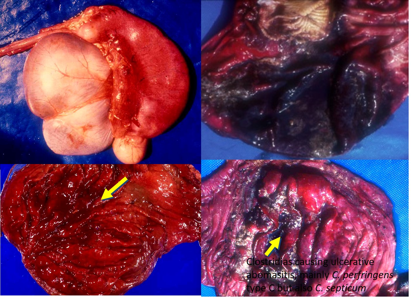 Gangrenous abomasitis in lambs and calves caused by Clostridium septicum