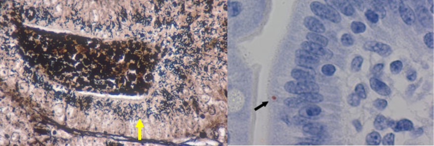 Proliferative enteropathies in foals and piglets are caused by an anaerobic, obligate intracellular, Gram-negative, curved, motile bacterium known as Lawsonia intracellularis. Although this bacterium is similar in morphology to Campylobacter/Arcobacter it is unrelated genetically. It belongs to the Family Desulfovibrionaceae.Equine strains have been found to be more related to rabbit strains than pig strains.The bacteria, once ingested, are assisted by helper bacteria in the intestines to adhere to and invade the immature intestinal epithelial cells of the small intestine, predominantly the ileum at the Peyer’s patches.