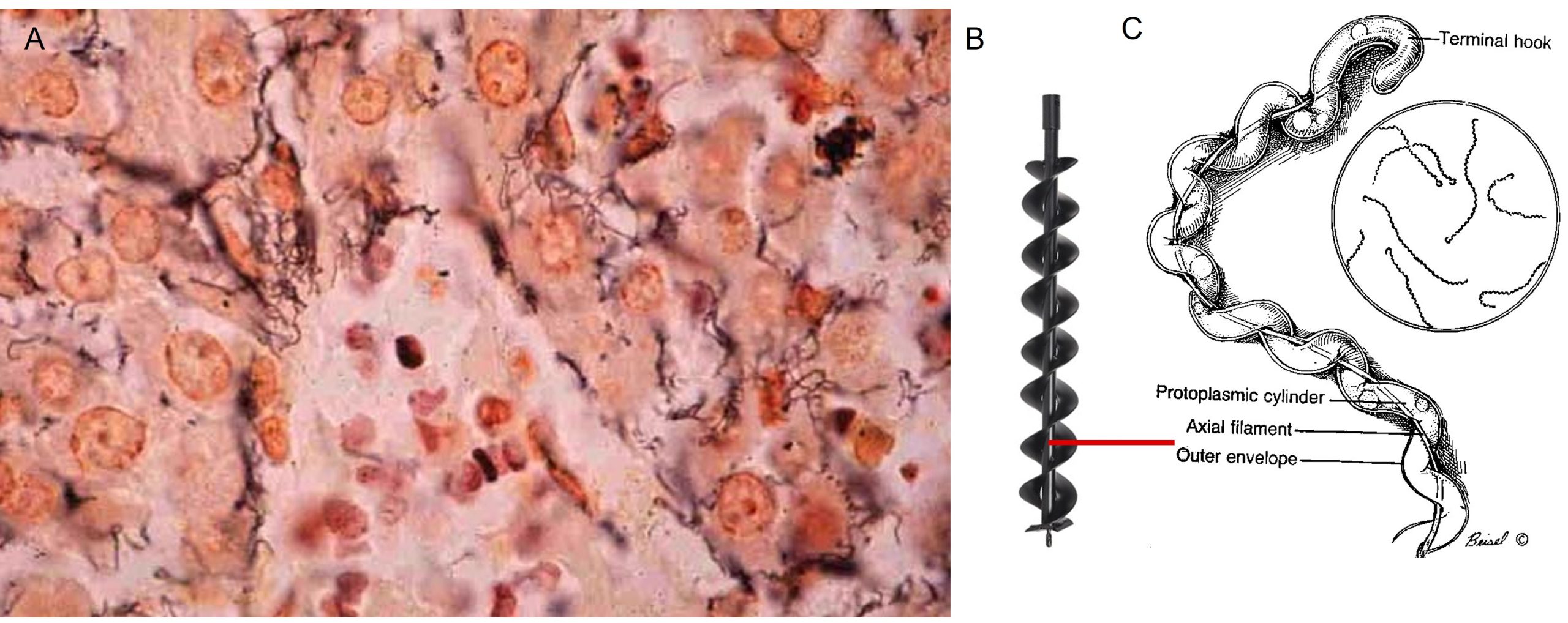 Leptospira morphology and function. Picture A: Silver staining of leptospires present in the renal tubules; B: Picture of post digging tool showing morphological resemblance to Leptospira. Picture C; diagram of a leptospire shoing the central axial filment and the spiraling of the bacteria around it. This morphology allows the bacterium to move forward in a circular movement allowing it to penetrate mucus and even through epithelia.