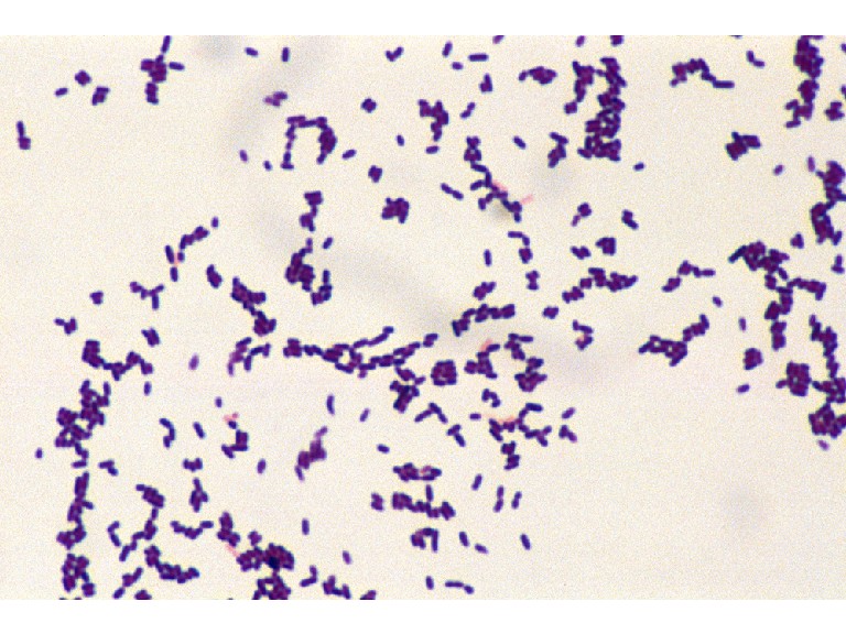 Gram stain from a culture of Listeria monocytogenes