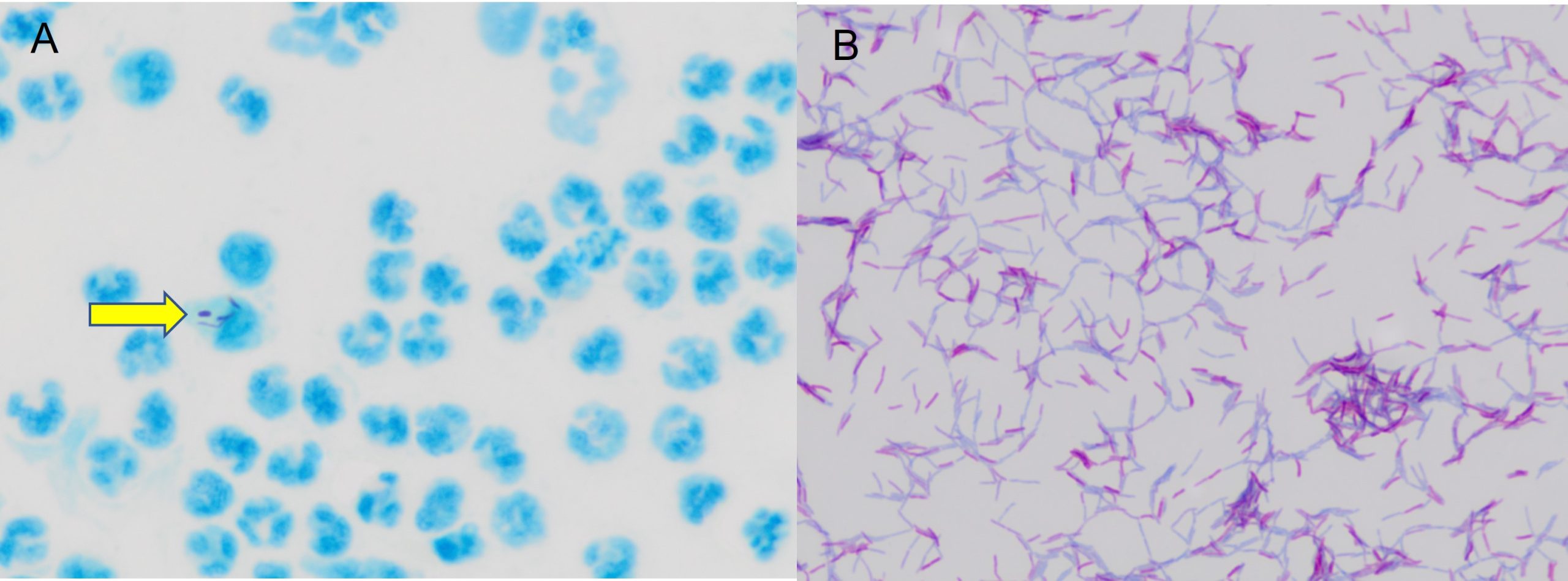 Acid-fast bacteria from a cat. Picture A: Scant, intracellular acid-fast bacilli (yellow arrow). Picture A: Acid-fast pleomorphic rods from a culture.