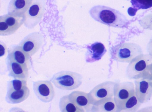 Borrelia anserina (spaghetti like structures) in the blood of an affected chicken