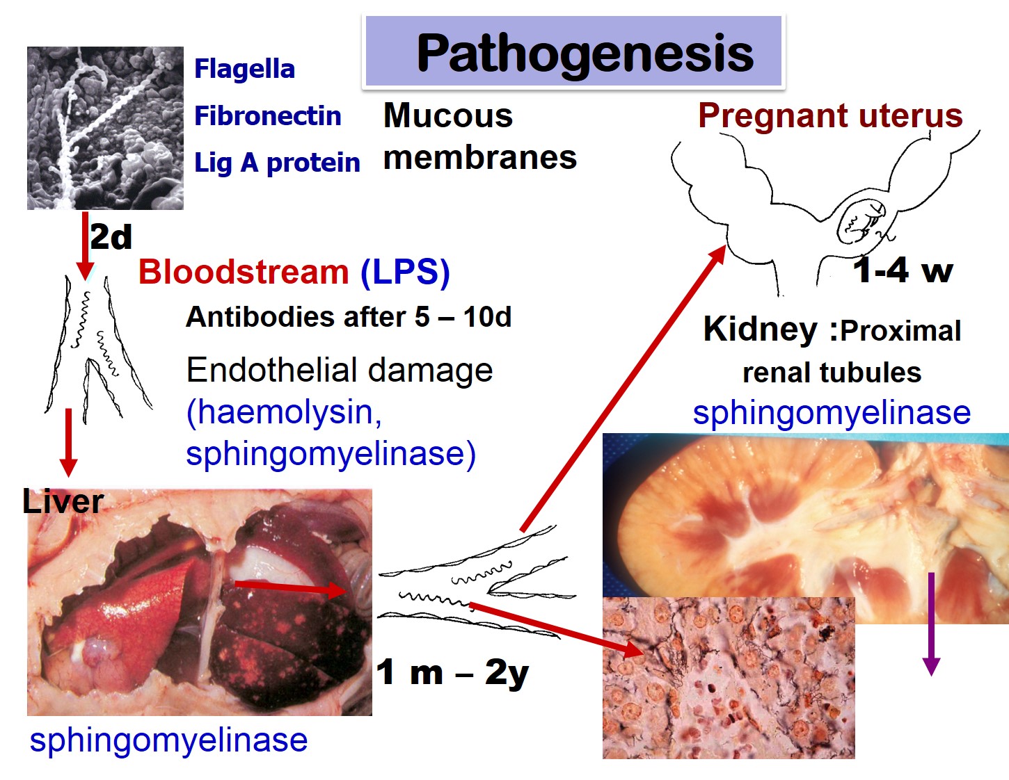 Pathogenesis of leptospirosis. Accidental hosts and foetuses suffer from the peracute (intravascular haemolysis) and acute forms (liver and renal disease) of the disease, whereas maintenace hosts mild or chronic disease (abortions, eye, chronic renal disease).