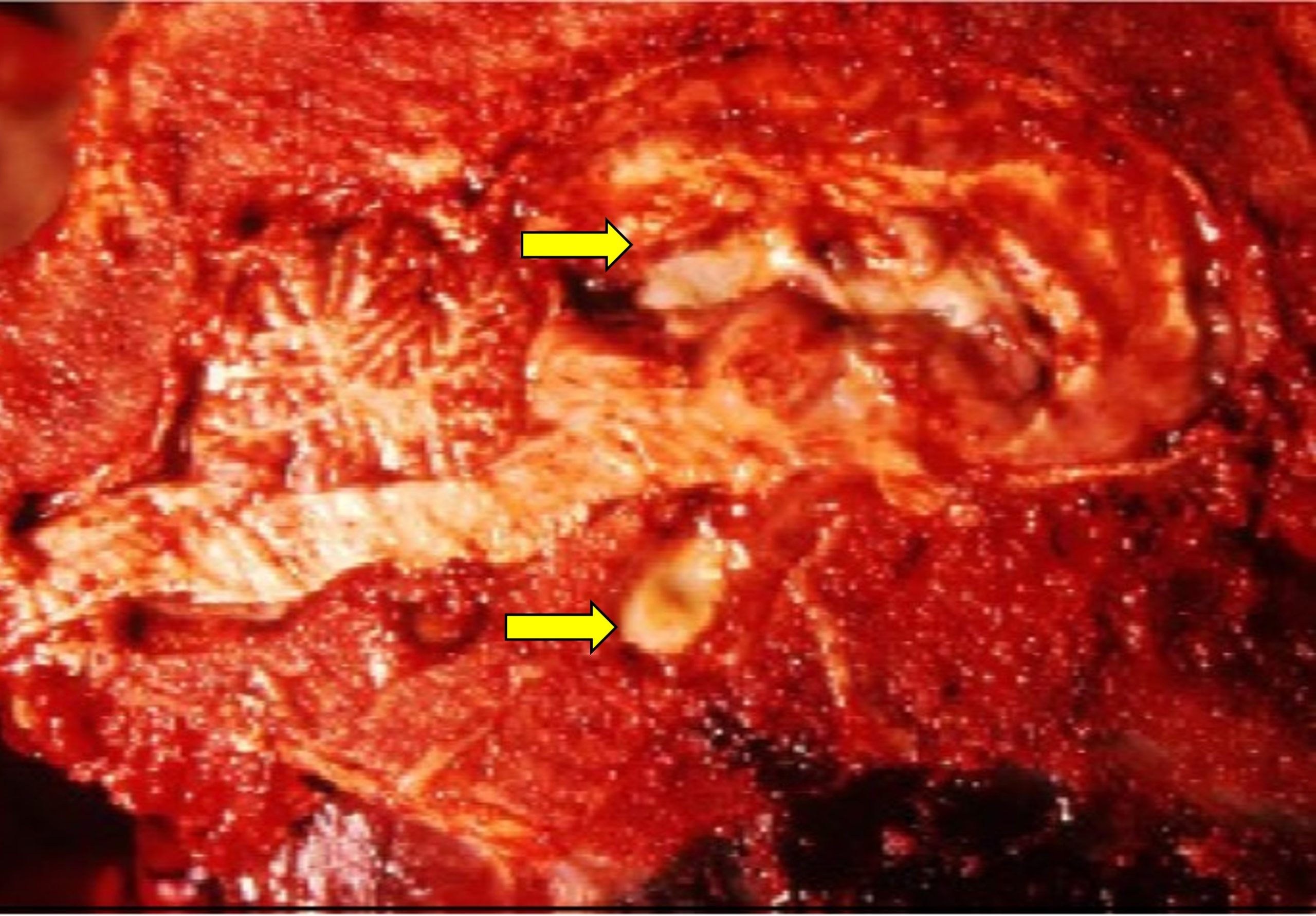 Pituitary abscess in a goat