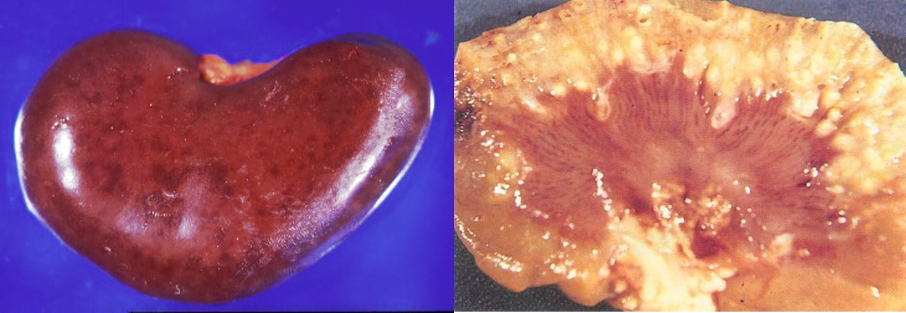 Congestion and necrosis of kidneys in sheep that had contracted salmonellosis