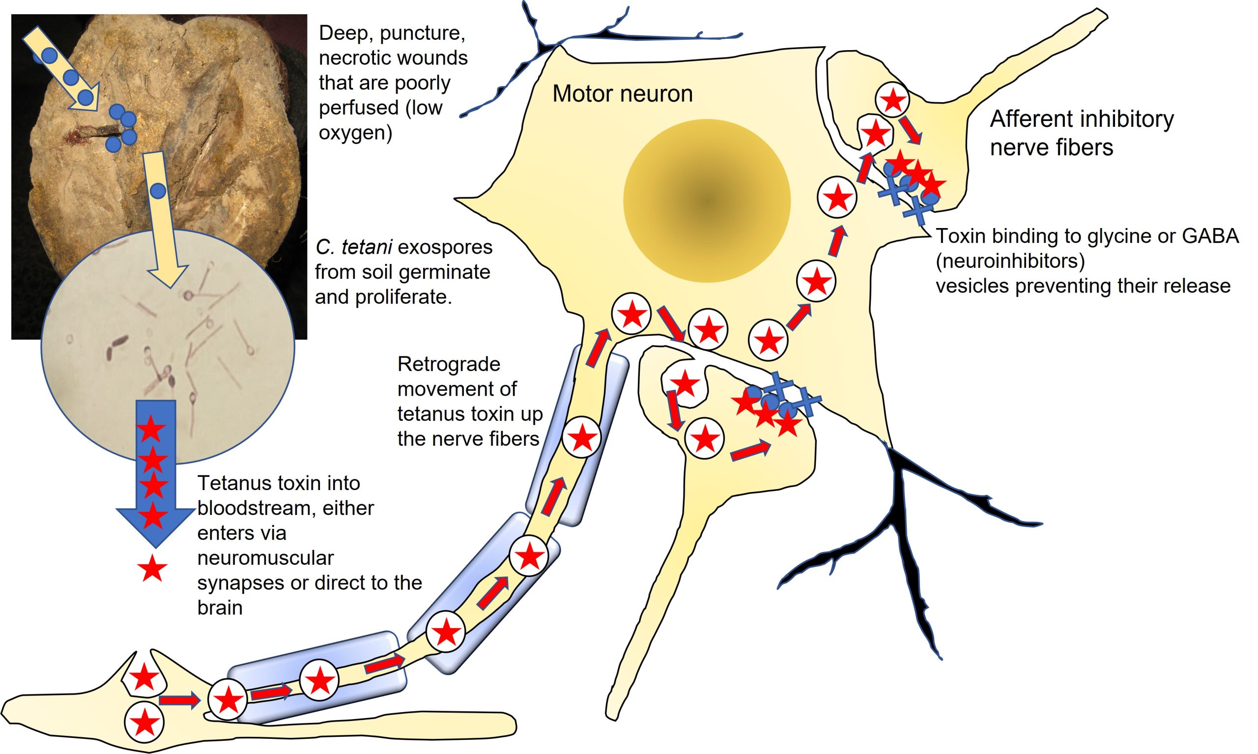Pathogenesis of tetanus exotoxin
