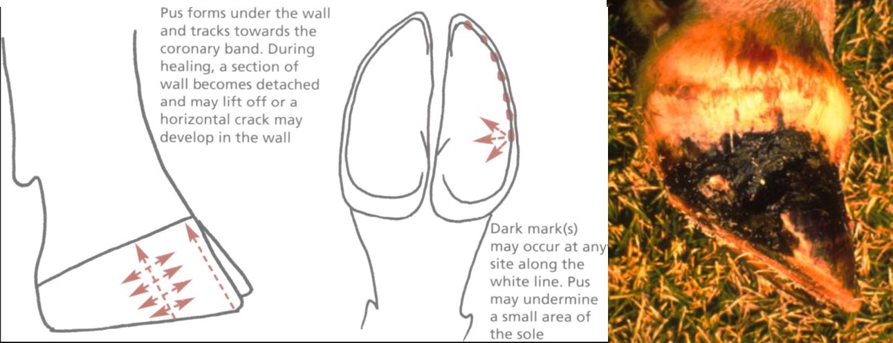 Toe abscess resulting from damage to the hoof lamellae. The exudate often breaks out at the back of the foot in the coronary band area. The exudate is often black and is subject to myiasis.