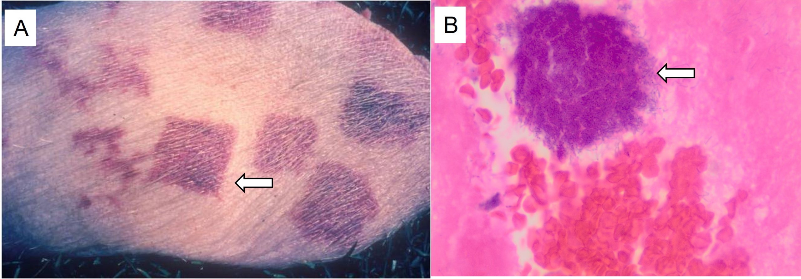 Typical lesions caused by Erysipelothrix rhusiopathiae in a pig