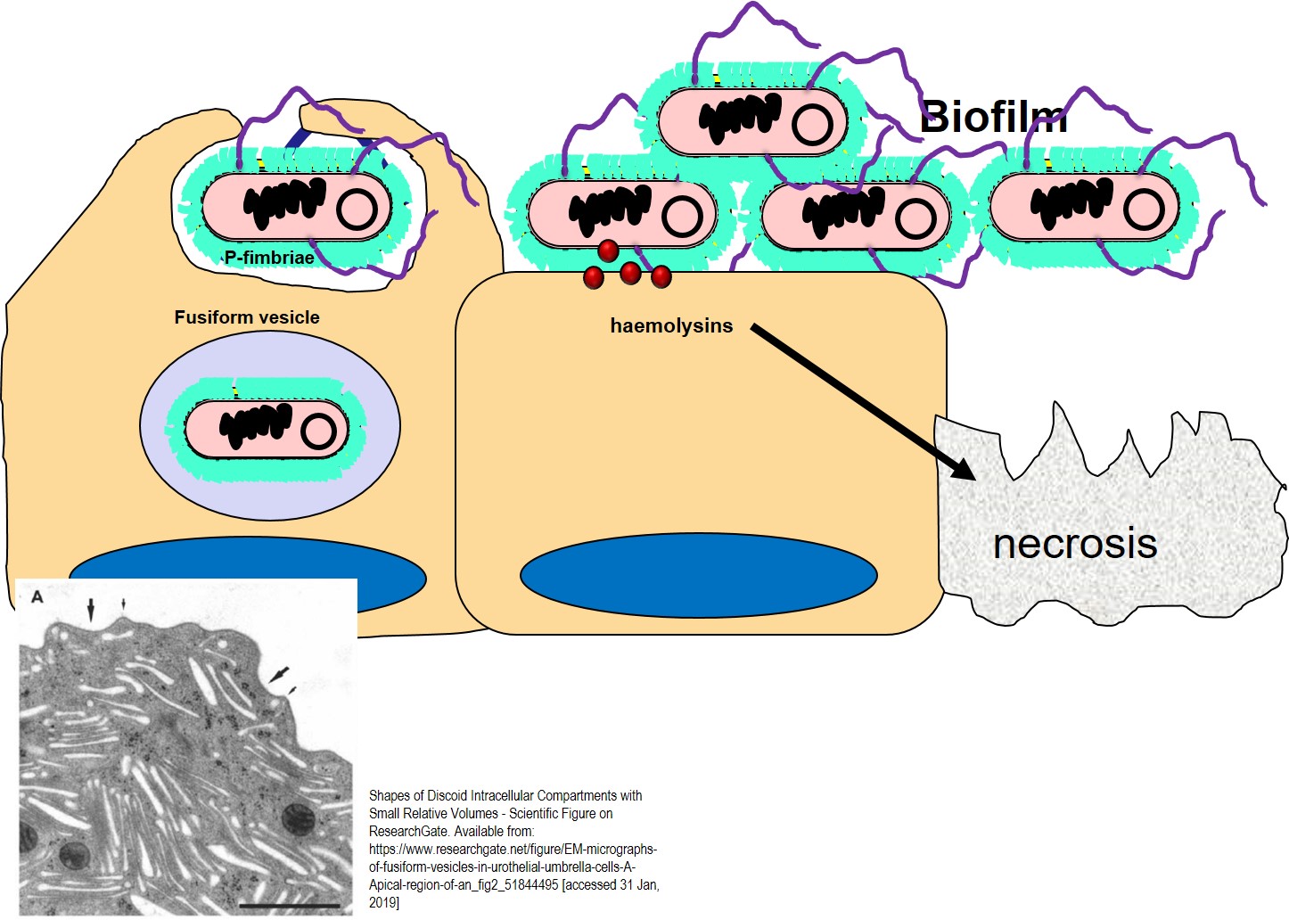 Uropathogenic E. coli after adhesion to the bladder epithelium using P-fimbrae form protective biofilms. They are also protected from the host by being internalised into umbrella cells of the bladder via the fusiform vesicle. Together with the inflammatory response, haemolysins produced by E. coli can assist in cell necrosis. Bladder cells also slough more rapidly in response to the presence of E. coli.