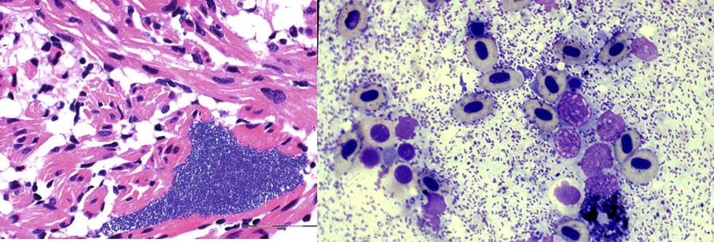 Bacterial sepsis in a fish. Left Picture: Histology section of muscle (H&E stain) showing a large bacterial colony. Right Picture: Modified Wright's stain showing large numbers of bacteria in the blood.