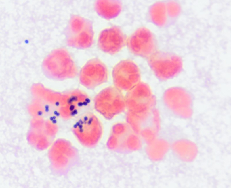 Grams stain of joint fluid aspirated from the left stifle joint of a dog