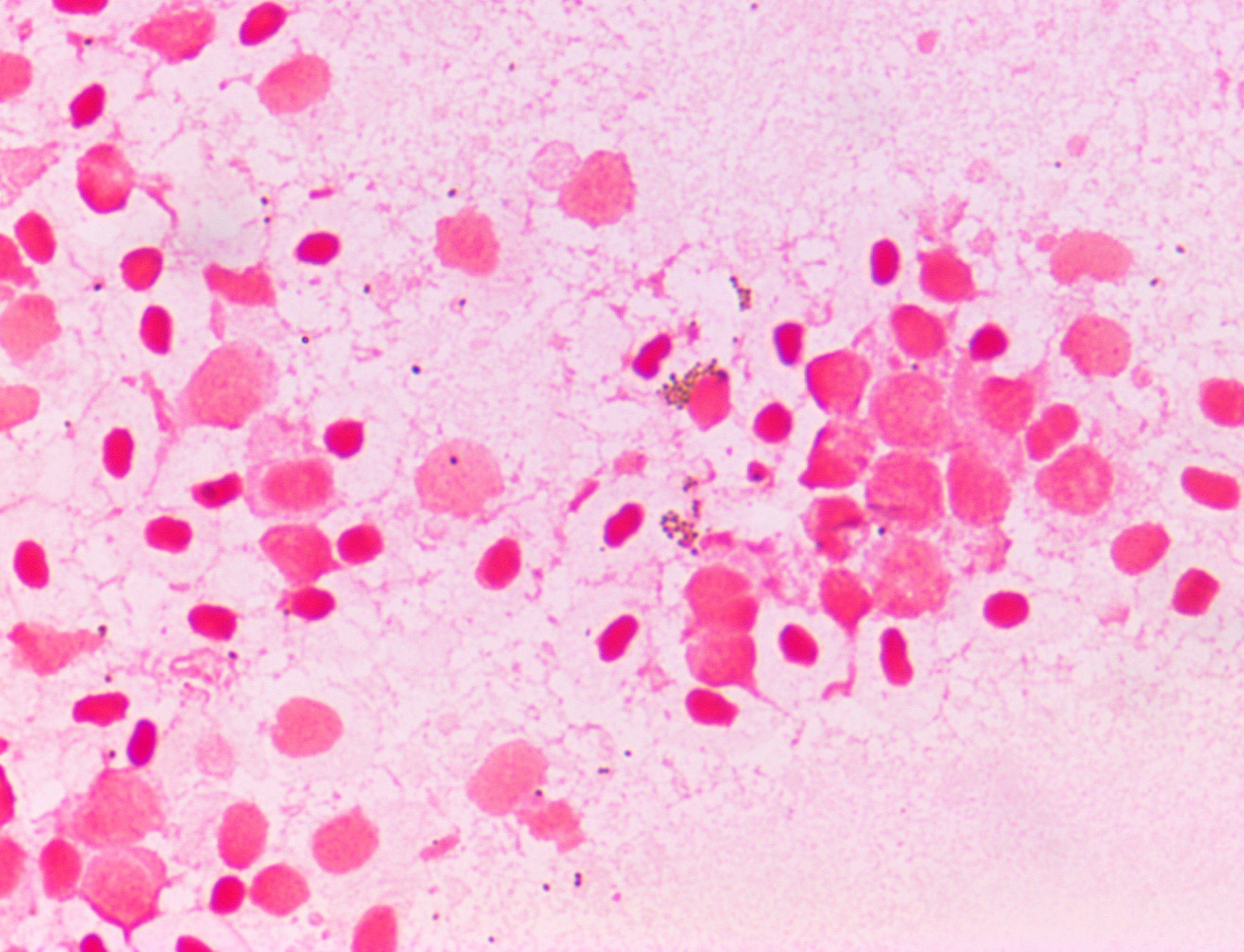 Fish cells with melanocytes that stain brown but can look like bacterial cocci
