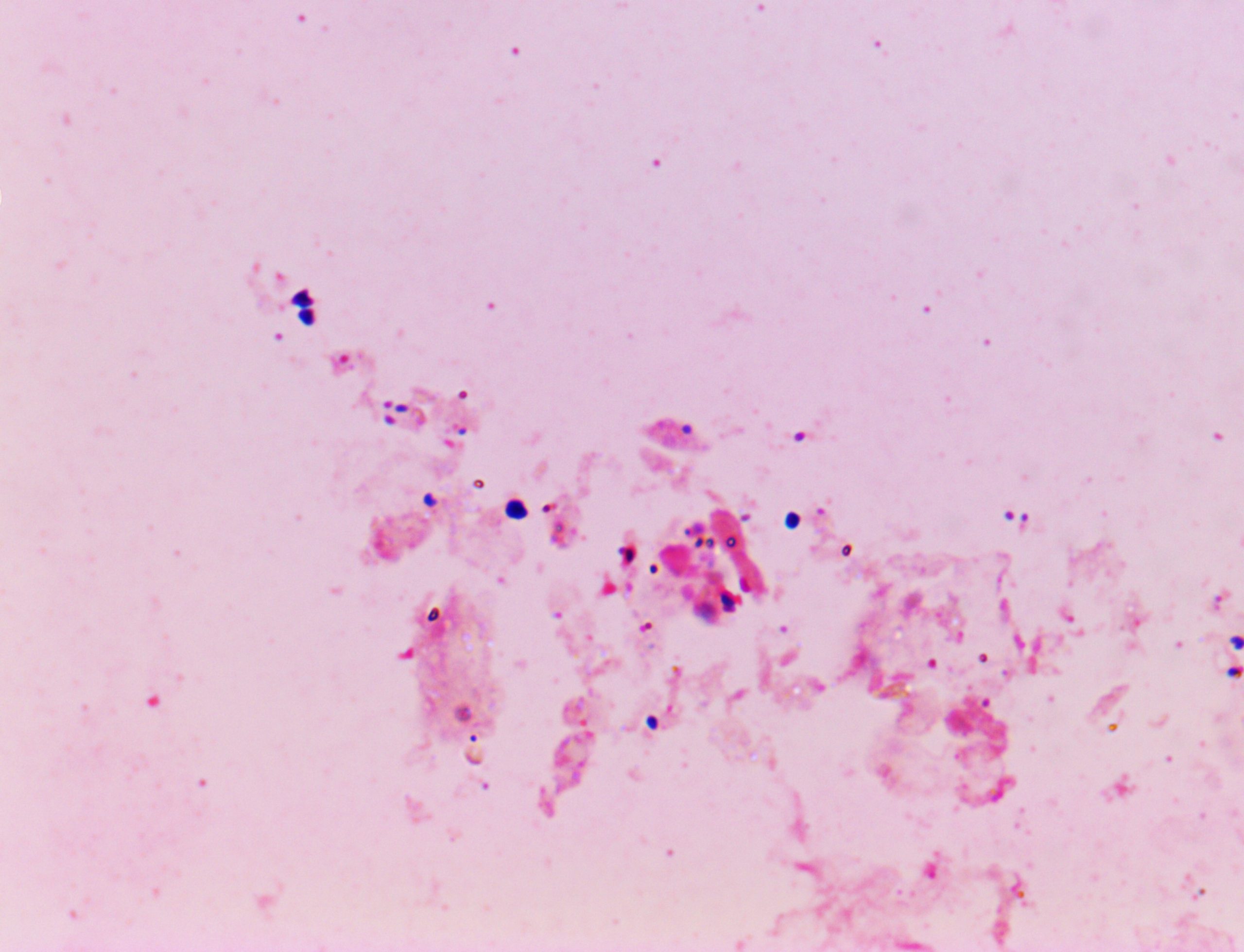Tracheal aspirate from a dog showing variably-sized blue stain deposits
