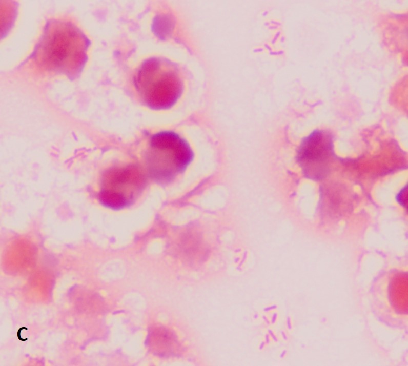 Gram's stain of bacteria in cow's milk stripped from a mastitic quarteric