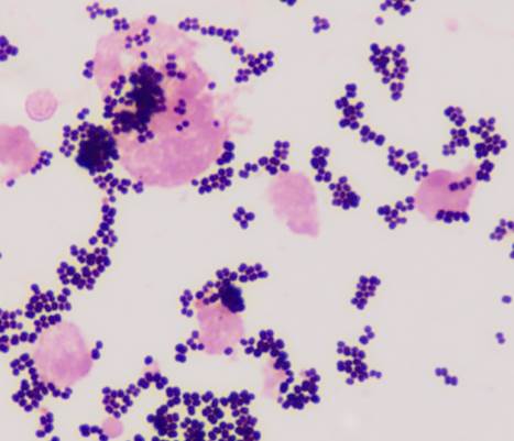 Gram's stain of urine ofrom a cat collected by cystocentesis