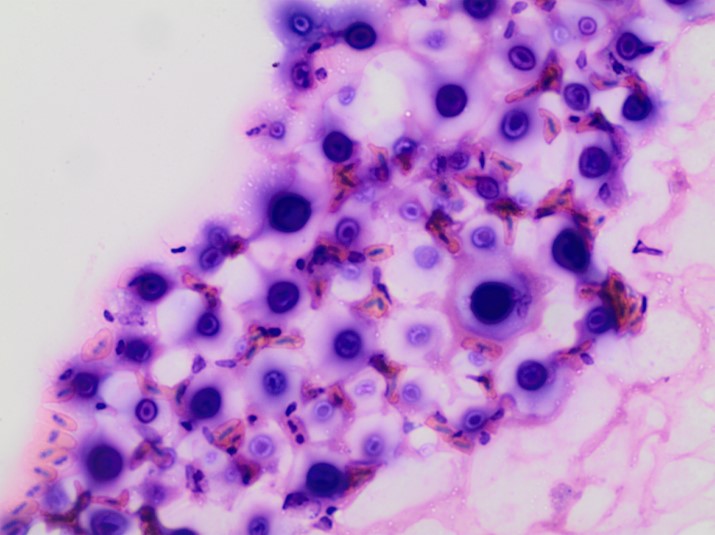 Cryptococcus in a nasal lavage from a parrot