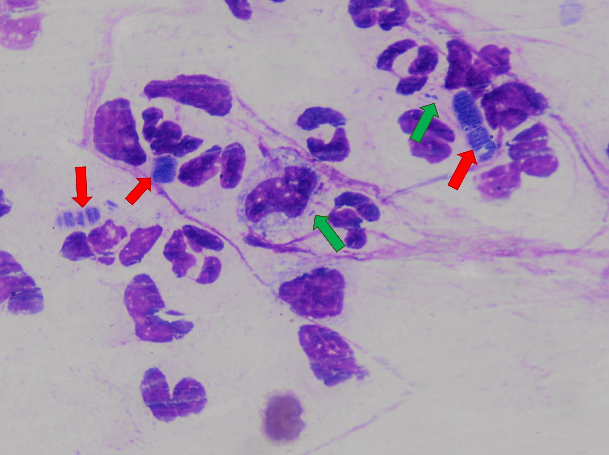 DiffQuik stain of Simonsiella in a nasopharynx