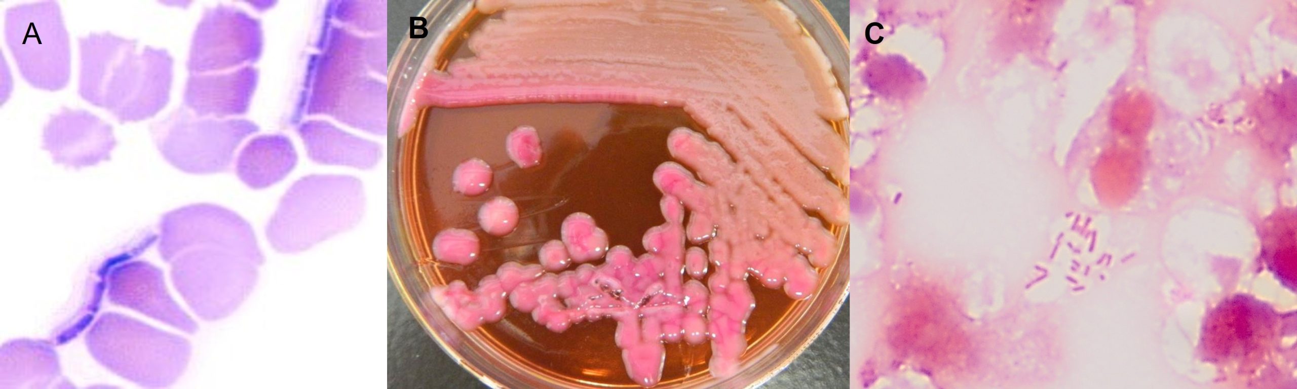 Bacterial capsules. A: Giemsa stain of Bacillus anthracis in blood. NOte the large brich shaped bacteria surrounded by a pale pink polysaccharide capsule; B: Culture on MacConkey agar of Klebsiella pneumoniae, a Gram negative bacterium. Note how the colonies appear glistening and slimy. This is evidence of the presence of thcik polysacchardie capsules surrounding these bacteria; C: Gram's stain of a capsulated Gram negative bacterium known as Escherichia coli. This Gram negative rod is found in the tissue as microcolonies. Surrounding the bacteria is a non-staining or clear zone. This represents the bacterial capsule. They do not stain with common stains.