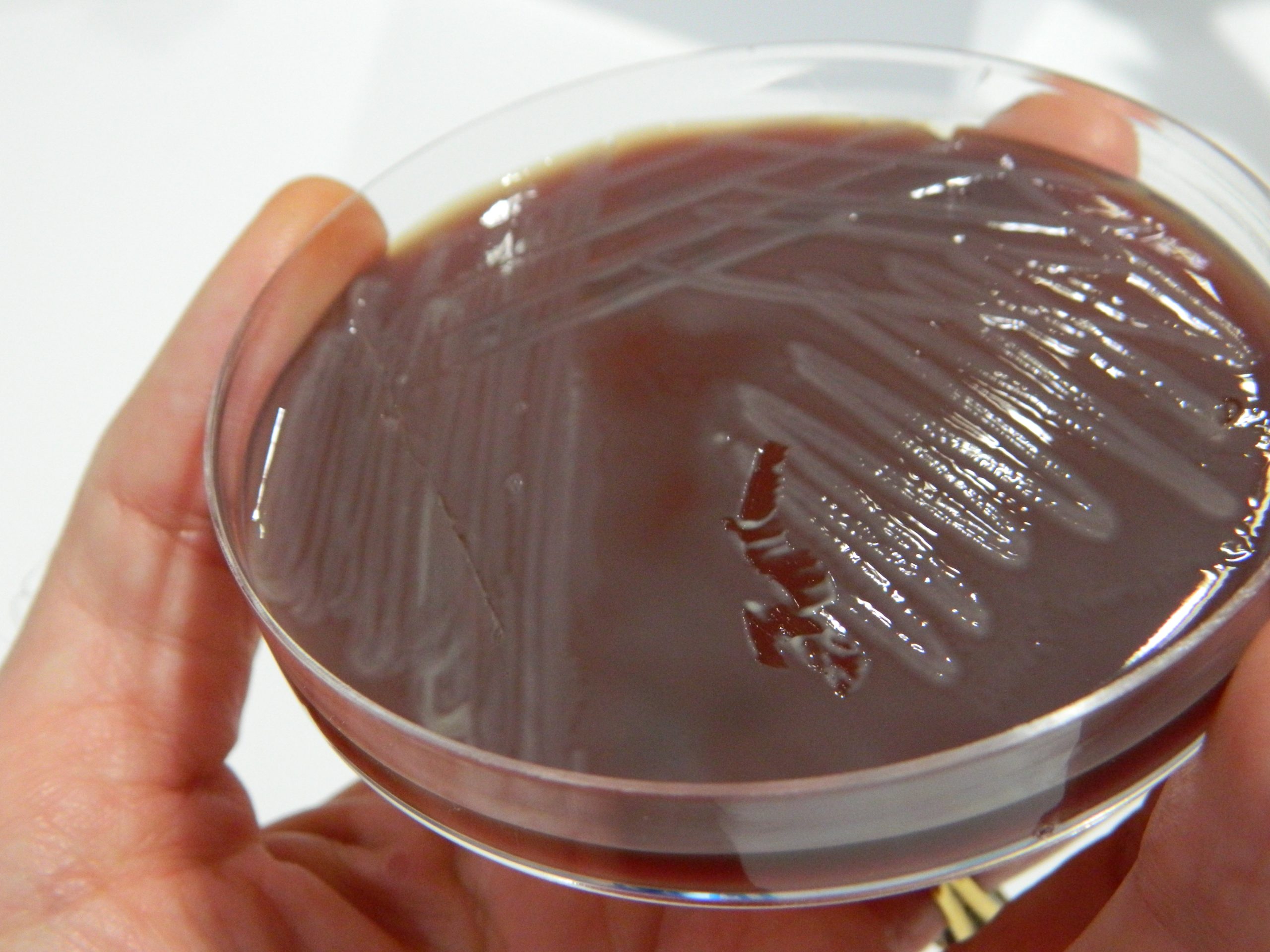 Proteus swarming over blood agar