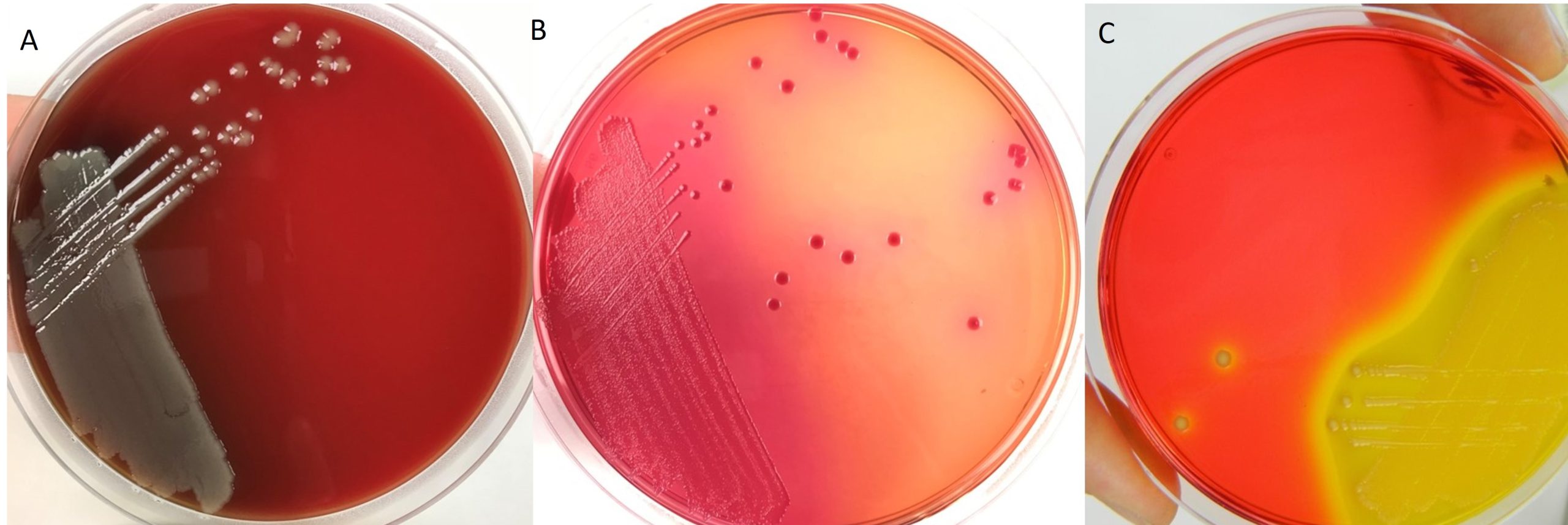 Use of different media types to grow Escherichia coli. A: Enrichment blood agar shows the typical morphology of Escherichia coli; B: MacConkey agar is a selective and differential agar. Escherichia coli grows on the media producing pink lactose-fermenting colonies; S: XLD agar is a selective and differential growth mediu, Escherichia coli produces sucrose fermenting yellow colonies